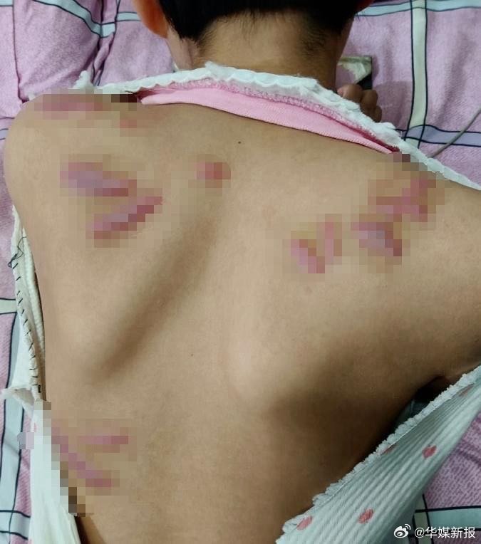 第1035页
